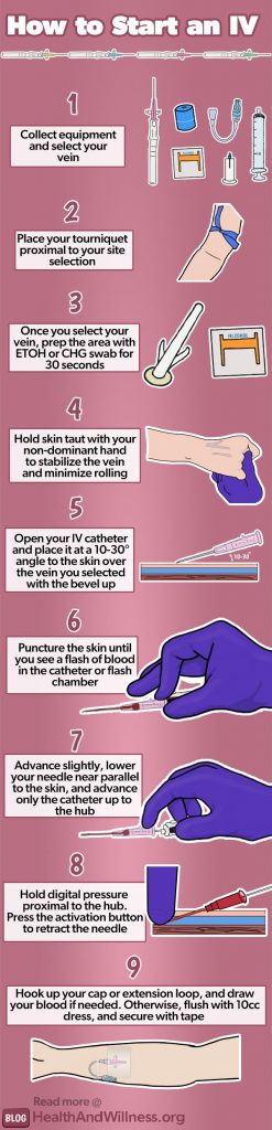 How to start an IV: infographic