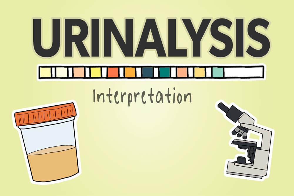 Urinalysis, Urinary Test, UA Urine Test Results