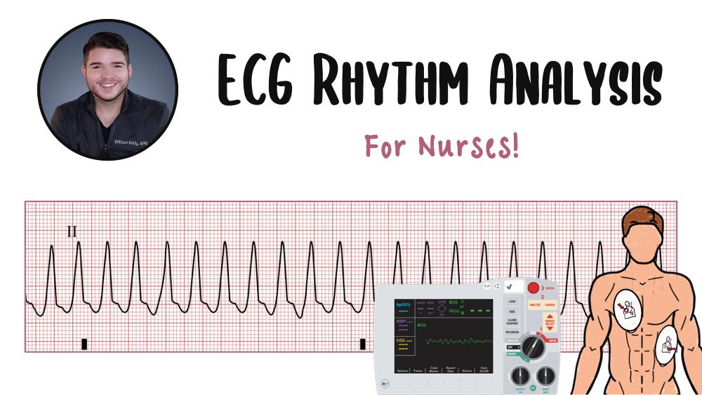 ECG Rhythm Analysis for Nurses Health And Willness