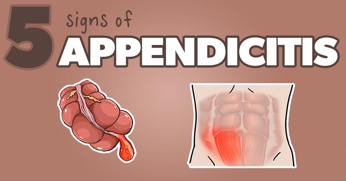 Appendicitis Signs And Symptoms