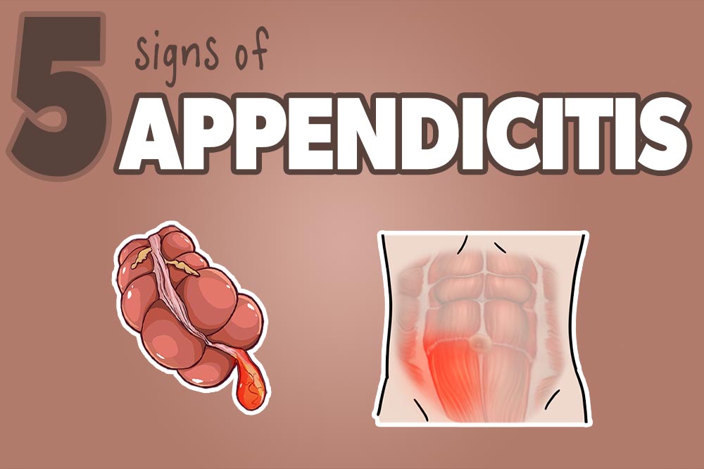 5 Appendicitis Signs you Don't Want to Miss! | Health And Willness