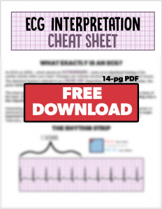 Nstemi Vs Stemi Cheat Sheet