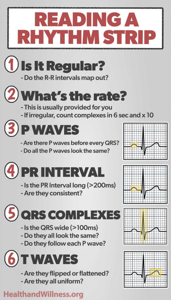 Cheat Sheet Ekg Strips Examples Basic Ekg Ecg Rhythms Cheatsheet ...