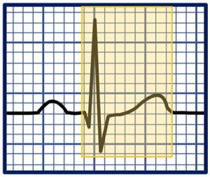 How to Read an EKG Rhythm Strip | Health And Willness