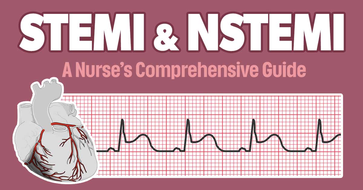 Stemi Nstemi A Nurse S Comprehensive Guide Health And Willness