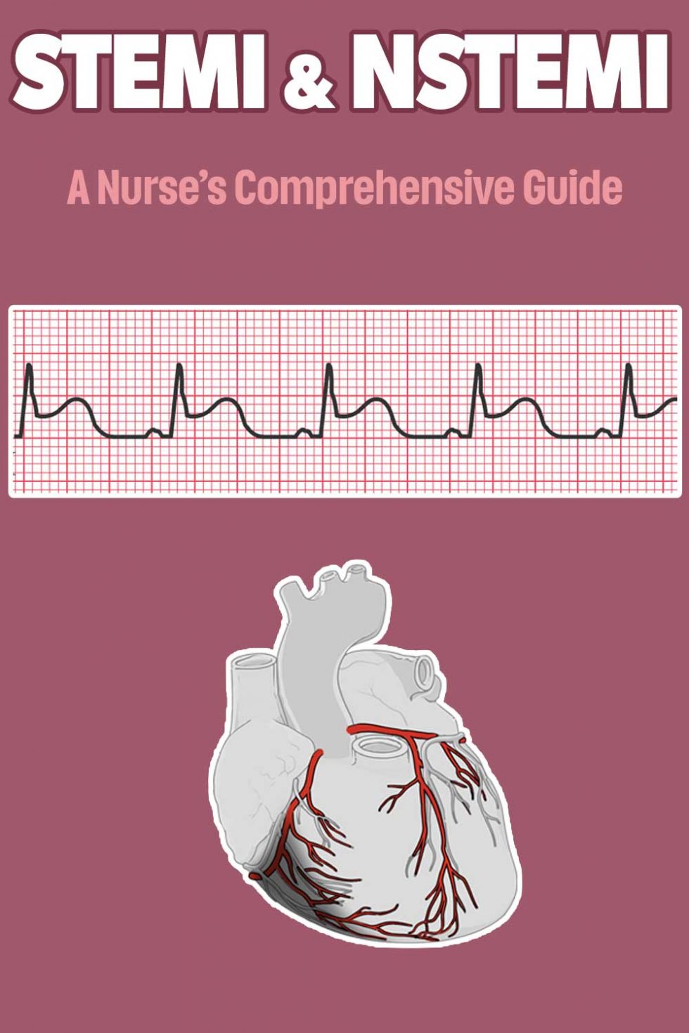 Stemi Nstemi A Nurse S Comprehensive Guide Health And Willness | Sexiz Pix