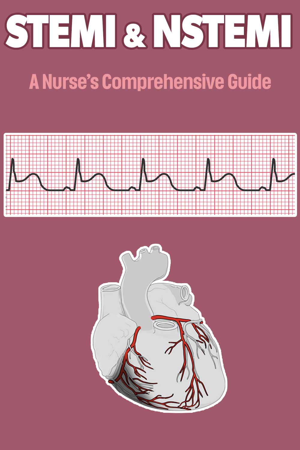 STEMI & NSTEMI: A Nurse's Comprehensive Guide | Health And Willness