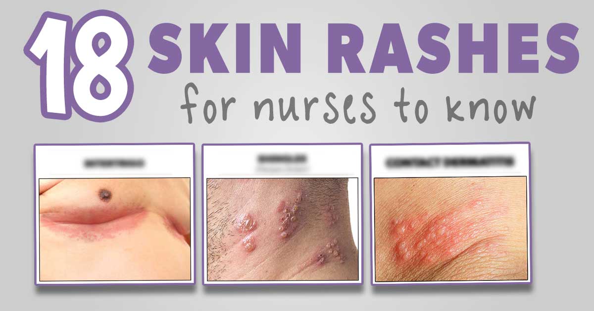 causes of rashes in adults