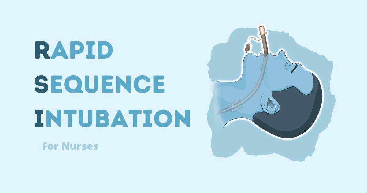 RSI Intubation for Nurses: Rapid Sequence Intubation