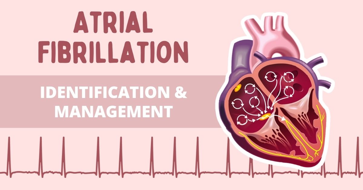 Understanding AFib: How to measure your own heart rate and rhythm - Scope