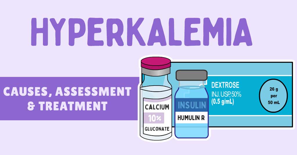 An Approach To Hyperkalemia ECG Changes In Hyperkalemia, 47% OFF